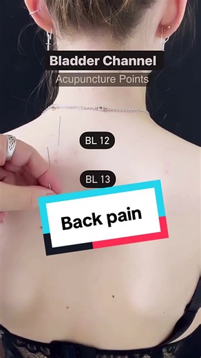 Needling Bladder Acupuncture Points for Health Benefits