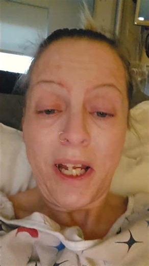 after amputation surgery feels