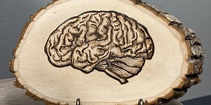 Trauma and the Brain