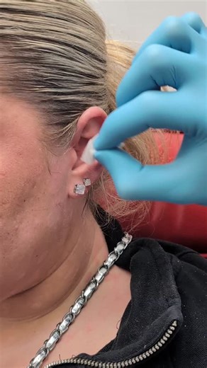 4.1K views · 16 reactions | A look behind the scenes as Angelo performs a surface tragus piercing. Clean technique, measured placement, and perfect control throughout. #PiercerCharliesCreations #PiercingStudio #PiercingStyle Find Ireland's largest collection of Fine Jewellery in-store at 7 D'Olier Street or online at our webstore, link in bio! https://piercercharliescreations.ie/ | Piercer Charlie's Creations | Facebook