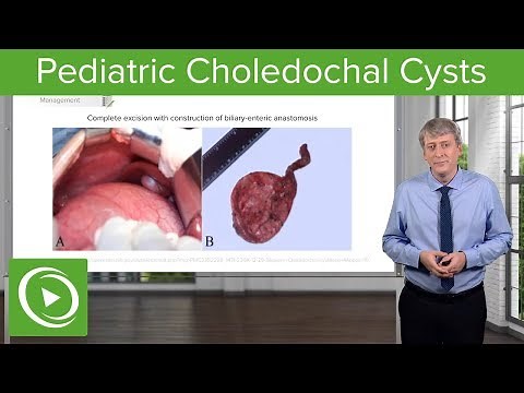 Pediatric Choledochal Cysts – Pediatrics | Lecturio