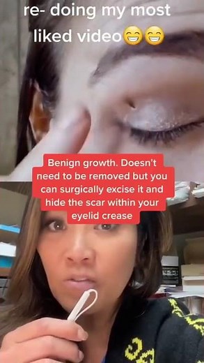 Why is HAIR growing on this eyelid. Dr. Pimple Popper Reacts #shorts