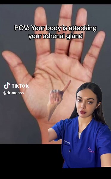 Understanding Addison's Disease: Causes, Symptoms, and Treatment