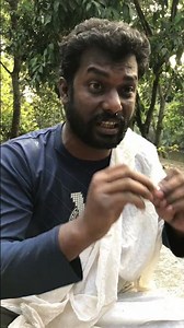 নাক দিয়ে পানি পড়তেছে/Nak diye jol portese #shorts #youtubeshorts #funny #comedy #youtube