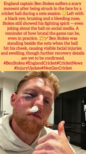Ben Stokes Injured! Brutal Net Hit Shocks Fans😱 #shorts #benstokes #uk #usa #england #london #canada