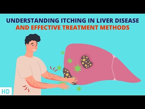 When Your Skin Crawls: Decoding Itching Associated with Liver Disease
