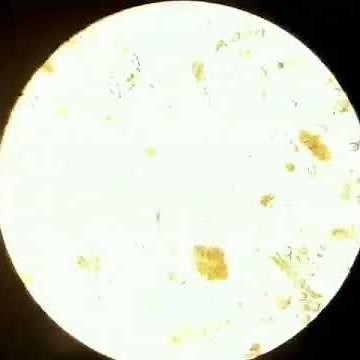 Trofozoitos de Giardia lamblia