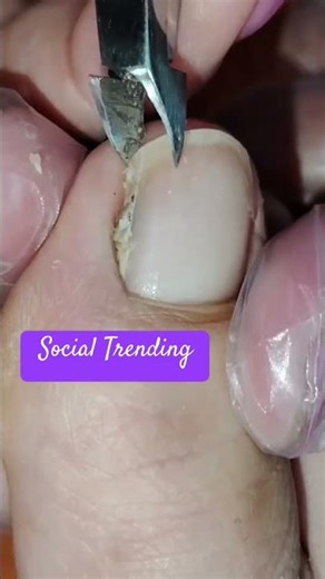 #Trendingvideo #trendingshort #trendingreels #nailcleaning