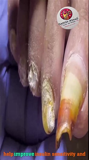 Daily tender nail bed habits for steady, gentle comfort 😚️ #HomeNailHabits #SoftCareRoutine #NailWellnessDaily | Danish irshad fans