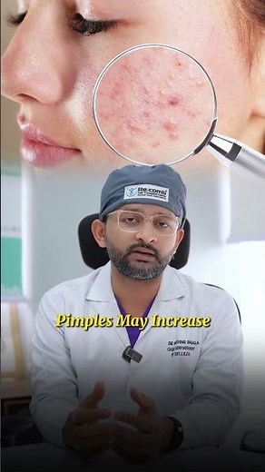 😱 Are your pimples getting WORSE after starting a new treatment? #SkinPurging #AcneTreatment