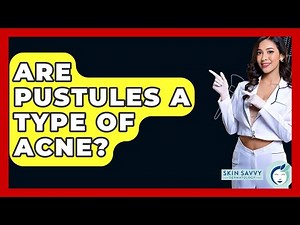 Are Pustules A Type Of Acne? - Skin Savvy Dermatology