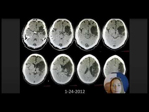 🎊 New #MedSLP Course on Cognition Impacts Through Neuroimaging & Medications 🎊