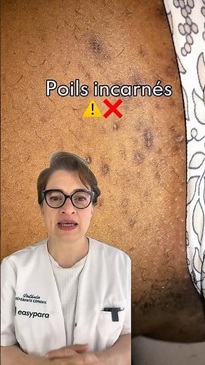 🚨 Si vous avez des poils incarnés, cette vidéo est pour vous ! 🚨