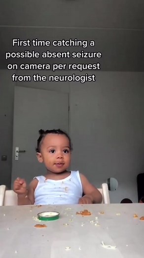 Understanding Absence Seizures: Symptoms, Causes, and Management