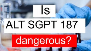 Is ALT SGPT 187 high, normal or dangerous? What does Alanine aminotransferase level 187 mean?