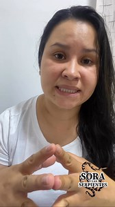 47K views · 1.1K reactions | Diferencias entre Bothrops asper y Bothrops atrox #snake #tendencias #viralreels | Sora y las serpientes | Facebook