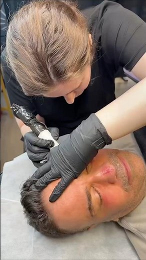 Tattooing Facelift Scars? See the Camouflage in Action 🔍