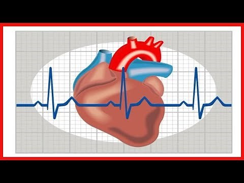 Le flutter auriculaire : causes et symptômes