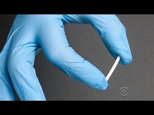 Buprenorphine implants; A new implant treatment for addicts