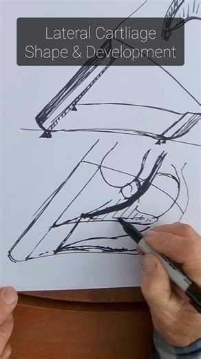 There is more to a hoof than just the HPA. What do your horse's lateral cartilages, hairline and horn tubules look like? Learning to assess these landmarks will give you valuable information about the level of development (or distortion), and help you to see past quick "fixes". #hoofbuilding #hooftrimming | David Landreville- On the Vertical
