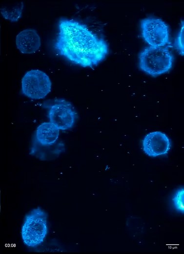 192K views · 1.5K reactions | When a cell dies, it doesn’t disappear,...