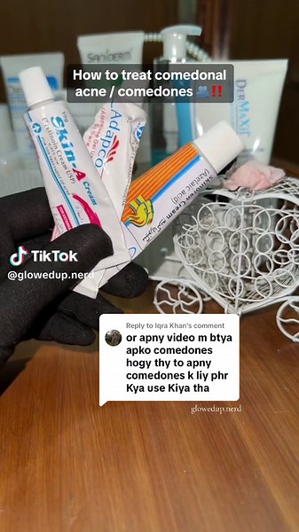 Replying to @Iqra Khan How to treat comedonal acne/comedones/whiteheads/blackheads . . . #skincaretiktok #glowedupnerd #whiteningcream #brightening #whiteningsoap #acnescars