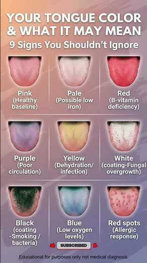 Your Tongue Color Reveals Your Health 😳 9 Warning Signs You Shouldn’t Ignore! #healthtips