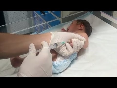 Newborn Care | Birth Asphyxia and Meconium Baby Treatment & Feeding