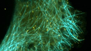 Microtubule dynamics