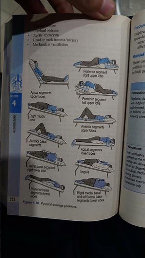 Postural Drainage Positions | Physiotherapy #exercise #anatomy #neet #viral #medical #positive