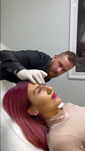 Incredible Nose Filler Transformation