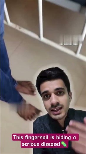 This fingernail is hiding a serious disease!. SUBSCRIBE🤗 #viral #neet #reels #shorts #trendingshorts