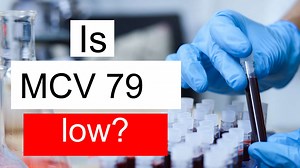 Is MCV 79 low, normal or dangerous? What does Mean corpuscular volume level 79 mean?