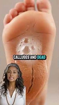 Soak your feet in hydrogen peroxide for 10 minutes before bed and watch what happens…
