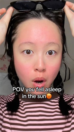 I fell asleep in the sun😡☀️my face going 🔥redred🔥but soothed my stressed skin in 5 minutes❤️