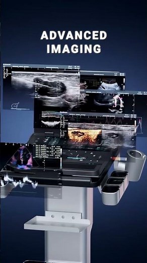 Introducing SonoScape E10 | AI-Powered Portable Ultrasound System | Coming Soon #viralshorts