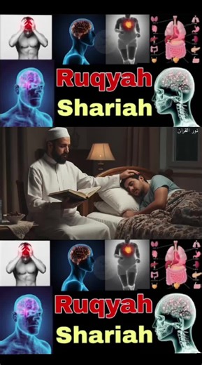 #ruqyah #jado