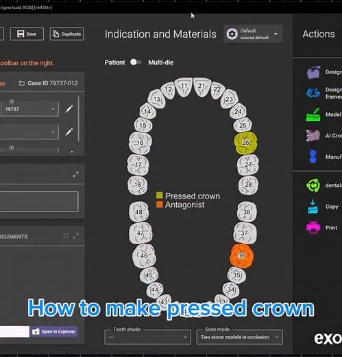 11K views · 1K reactions | #dentaltechnology exocadofficial #dentalstudent # #dentaltechnican #dentallab #dentalassistant #dentalimplants# #dentalimplants #dentalcare #dentalhygiene #dentaldesign ##exocad_training #egypt #jordon #lebanon #iraq #طلبه_اسنان_الازهر #morroco #makkah #riyadh #jeddah #tunisia #albania #dental_student #unitedkingdom# #unitedstates #unitedarabemirates #united_dental_labor #tunisie #russia #unitedkingdom | Exocad training | Facebook