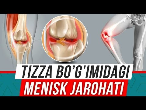 TIZZA OGRIQLARI VA ENG OSON DAVOSI.#rek ##reels # #doctorMuzb #uzbomtv #doctoruz #SHIFOKORMUHAMMAD..