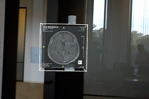 Holoframe Display for medical images