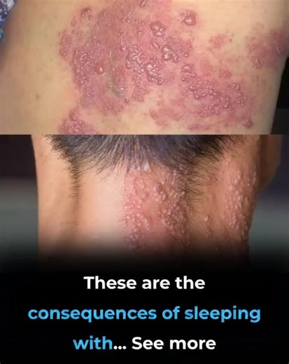 These are the consequences of sleeping with... See more | K Line Global