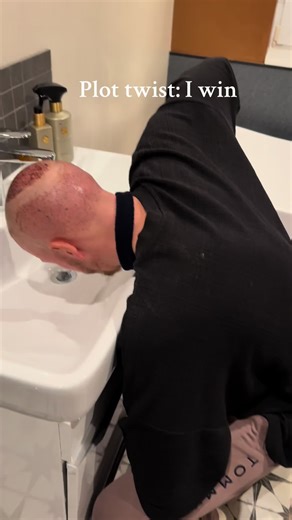 Plot twist: I win #turkey🇹🇷 #hairtok #fy #pov #hair