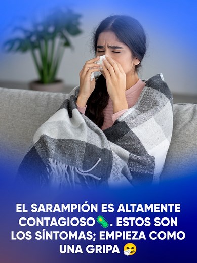 El sarampión es altamente contagioso🦠. Estos son los síntomas; empieza como una gripa 🤧, explica el doctor David Kershenobich. #TikTokInforma #TikTokMeHizoVer #Sarampión #Sheinbaum
