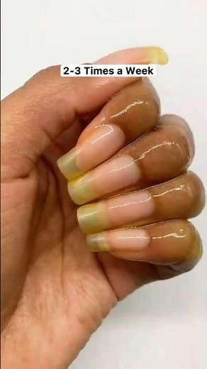 How to grow nails fast overnight || faster Nail growth remedies to long and strong nails ||#nails