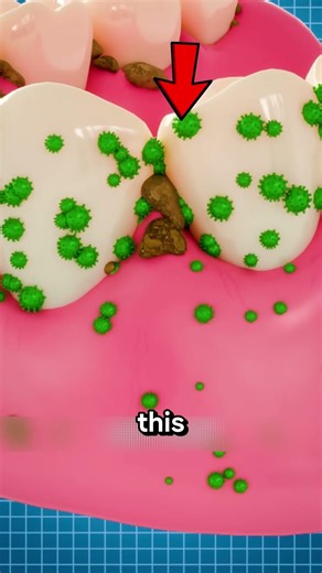 What Would Really Happen If You NEVER Brush Your Teeth!