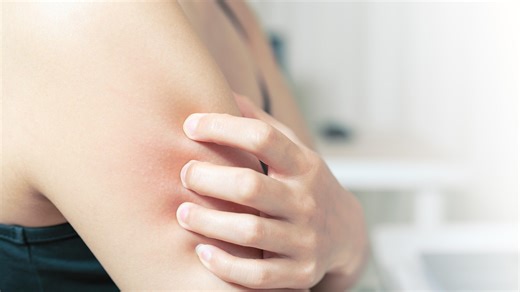 Osteoporosis screening guidelines updated: What to know