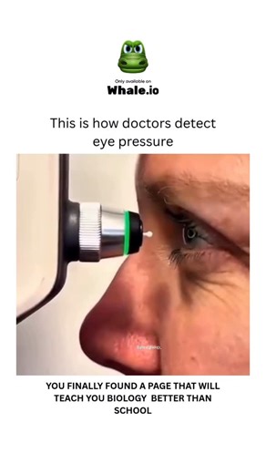 BIOLOGY | MEDICAL | HEALTH on Instagram: "Doctors detect eye pressure, also called intraocular pressure (IOP), using a tonometry test. There are two main methods: non-contact tonometry, which uses a puff of air to measure how much your cornea moves, and applanation tonometry, which involves numbing the eye with drops and gently touching the cornea with an instrument to measure the force needed to flatten it. Dm for credit or removal 👏🏻🙏🏻 For educational purposes only…….. #viral #explore #exp