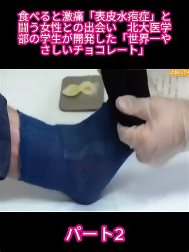 食べると激痛「表皮水疱症」と闘う女性との出会い 北大医学部の学生が開発した「世界一やさしいチョコレート」#闘病 #ドキュメンタリー #感動ストーリー #北大医学部 #看護 #病気と闘う #Inspiration #RareDisease #LifeStruggle #foruyou #foryoupage❤️❤️