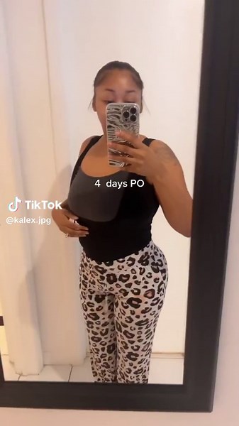 I really bought a new body 😅 getting my 5th massage today 🫠 #bblrecovery #bbljourney