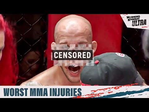 Breaking Down The Worst MMA Injuries Of All-Time | MK ULTRA